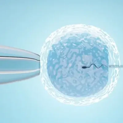 IVF Treatment